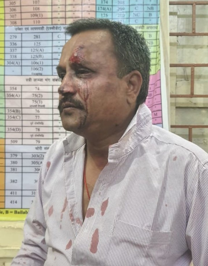 रतलाम से भाईदूज मनाने उज्जैन गए दो भाइयों के साथ गाड़ी टकराने की बात पर मारपीट, आंख और चेहरे पर गंभीर चोट रतलाम से भाईदूज मनाने उज्जैन गए दो भाइयों के साथ गाड़ी टकराने की बात पर मारपीट, आंख और चेहरे पर गंभीर चोट
